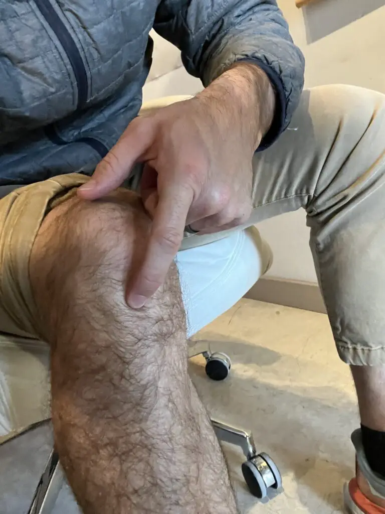 patellar tendonitis